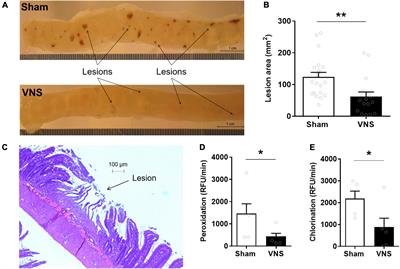 Vagus Nerve Stimulation Reduces Indomethacin-Induced Small Bowel Inflammation